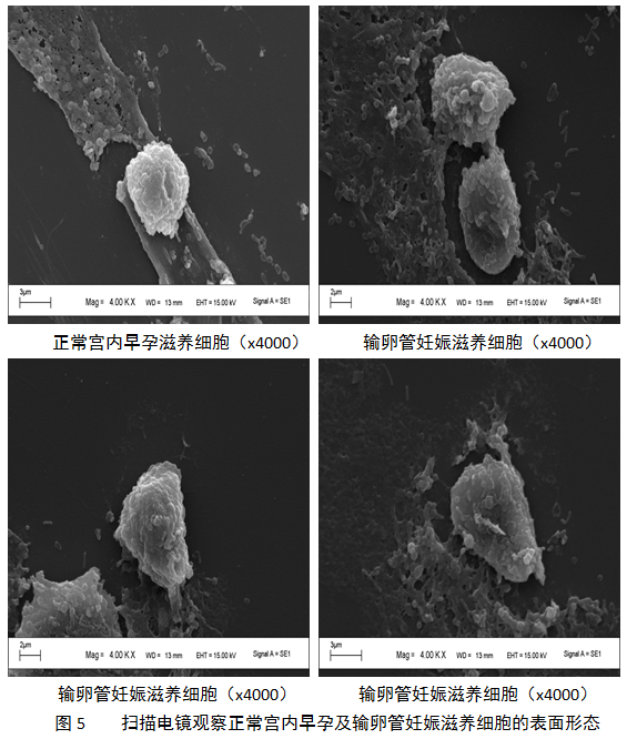 化瘀消症杀胚中药复方对输卵管妊娠滋养细胞影响的实验研究